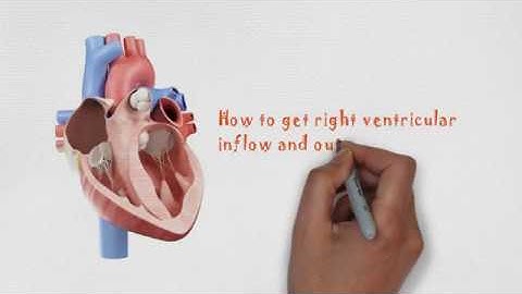 Echo I POCUS I RV inflow and outflow views from the parasternal window - Dr. Koratala (@NephroP)