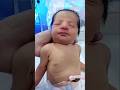 Low Birth Weight Baby Recovery | NICU Care, Monitoring &amp; Healthy Progress