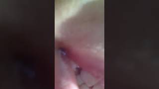 Versión 2 del video