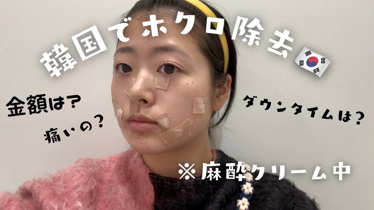 韓国でホクロをたくさん除去してきました😳