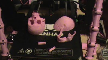 Human skull assembly 3D printed