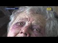 На Сумщині знайшли 88-річну жінку, яку мало не забили до смерті