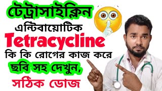 What do Tetracycline Antibiotics work, Tetracycline intake rules, Tetracycline medicine@cpdrubelm...