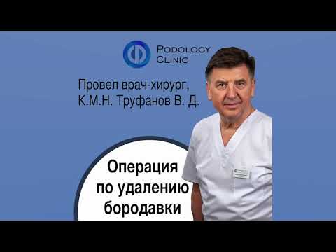 Удаление бородавки на пальце стопы - проводит хирург, КМН Труфанов Вадим Дмитриевич