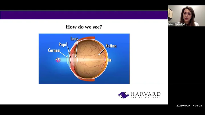 Factors Affecting Cataract Surgery Results