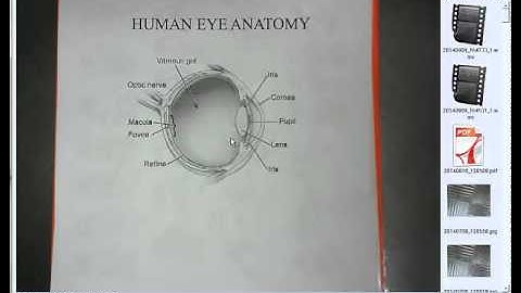 SimplicityCam Troubleshooting: Wrong camera or blurry image.