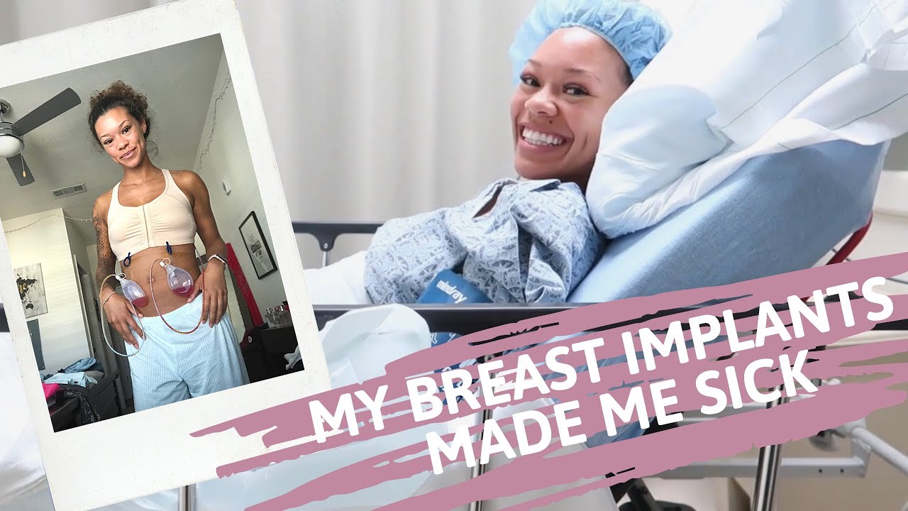 MY BREAST IMPLANTS MADE ME SICK! Breast Implant Illness & What to