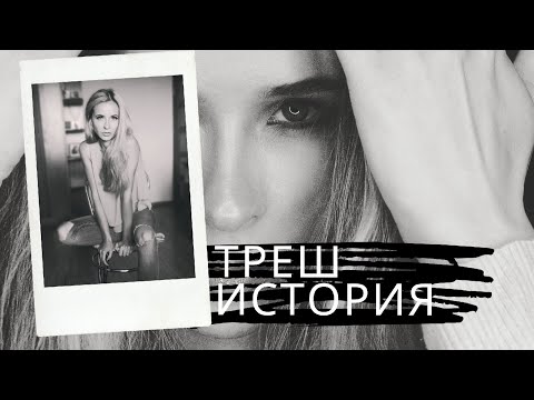 ТРЕШ ИСТОРИЯ! Не могла ходить! Ожог 3 степени + ШОКИРУЮЩИЕ ФОТО!