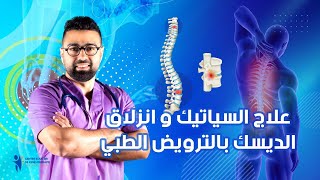 بروتوكول علاجي للانزلاق الغضروفي و عصب السياتيك