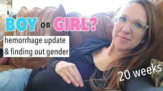 20 Week Pregnancy Update // GENDER REVEAL!