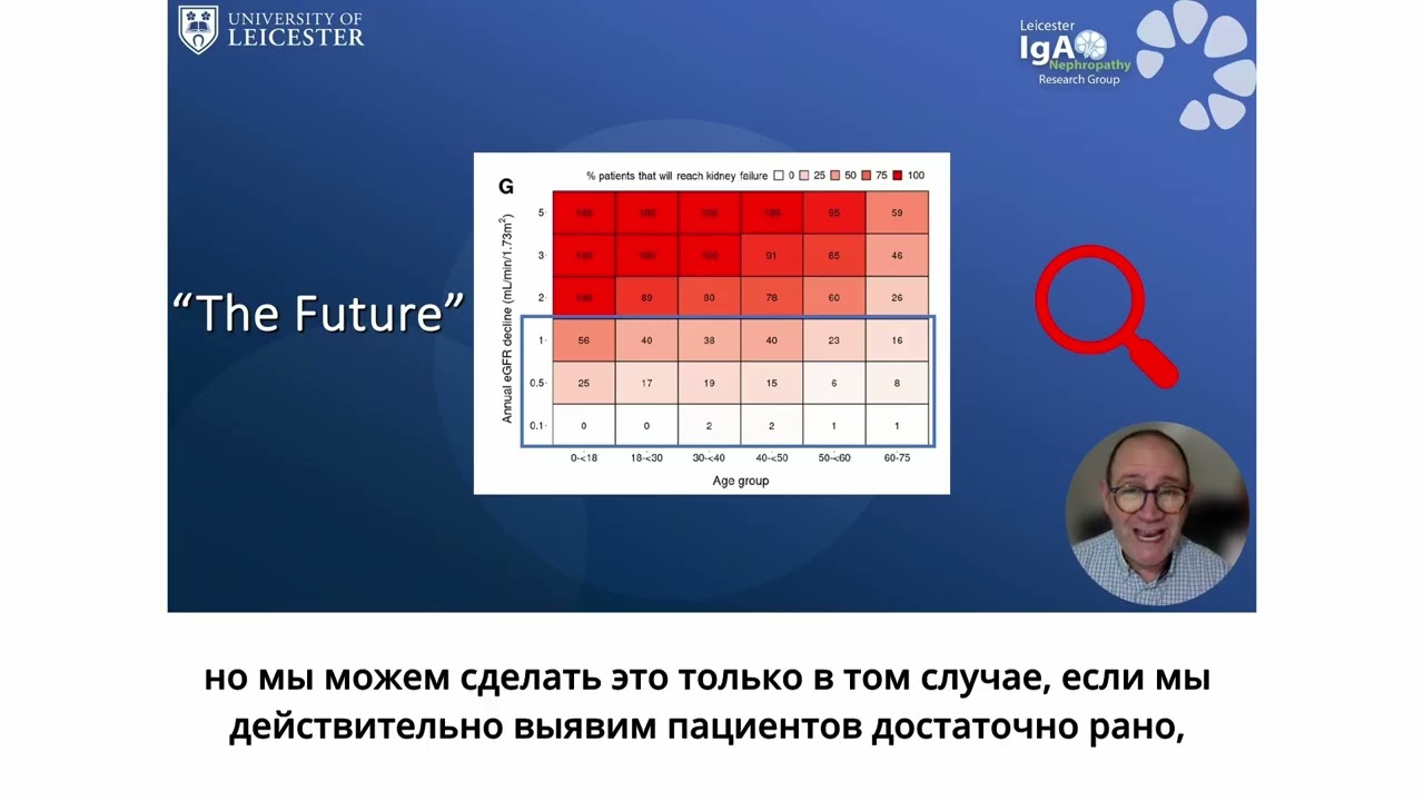 Russian Dialysis Society Meeting Presentation: KDIGO 2025 IgAN Guideline Update