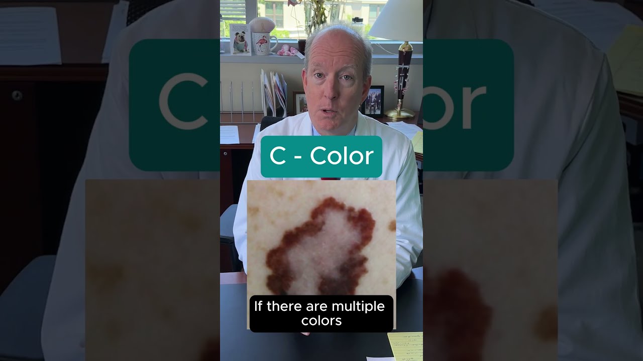Is it a Mole or Melanoma?