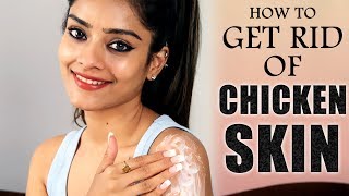 DIY | How To Get Rid Of  Chicken Skin | Skincare Tutorial | Remove Chicken Skin | Foxy