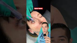 Doctor Explains Eye Lubricant