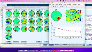 Tutorial for basic preprocessing of EEG signals using EEGLAB
