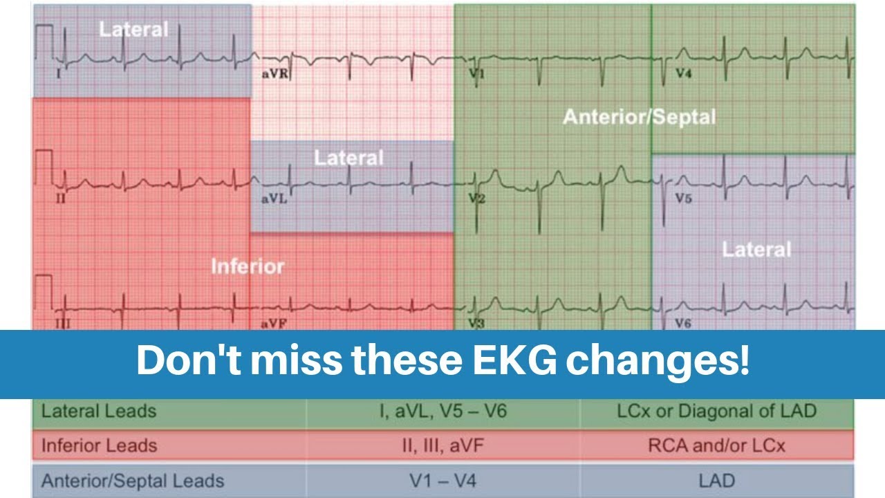 How To Read An Ecg