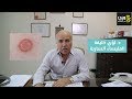 مرض المليساء المعدية السارية مرض المليساء المعدية السارية