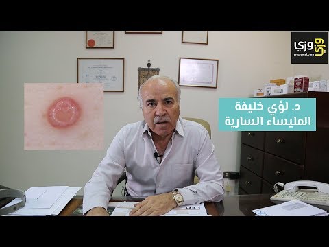 فيديو: من يمكنه الإصابة بالمليساء المعدية؟