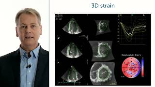 How can functional information be displayed in 3D echocardiography?