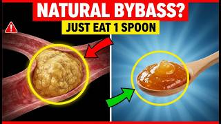 The Enzyme That Dissolves Arterial Plaque (Cardiologists Won't Tell You This)