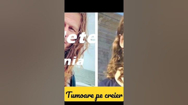 TRAGIC! Mircea Solcanu are o tumoare pe creier si nu mai aude #vedeteliveromania