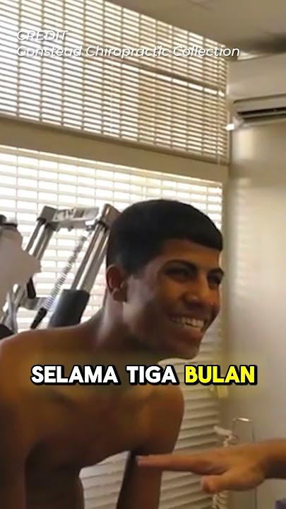 Cara Dokter Menyembuhkan Punggung Bengkok
