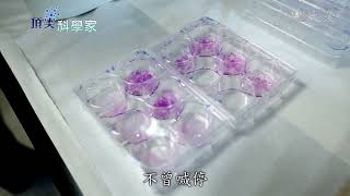 鑽研腎臟內科 蔡任弼用專業撼動世界