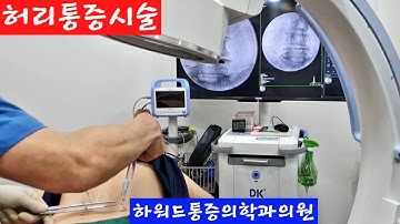 허리통증시술(신경차단술   재생주사)