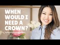 When Would I Need A Crown? | Thrive Dental and Orthodontics