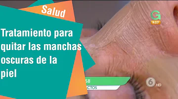 ¿Cómo puedo eliminar mis manchas oscuras rápidamente?