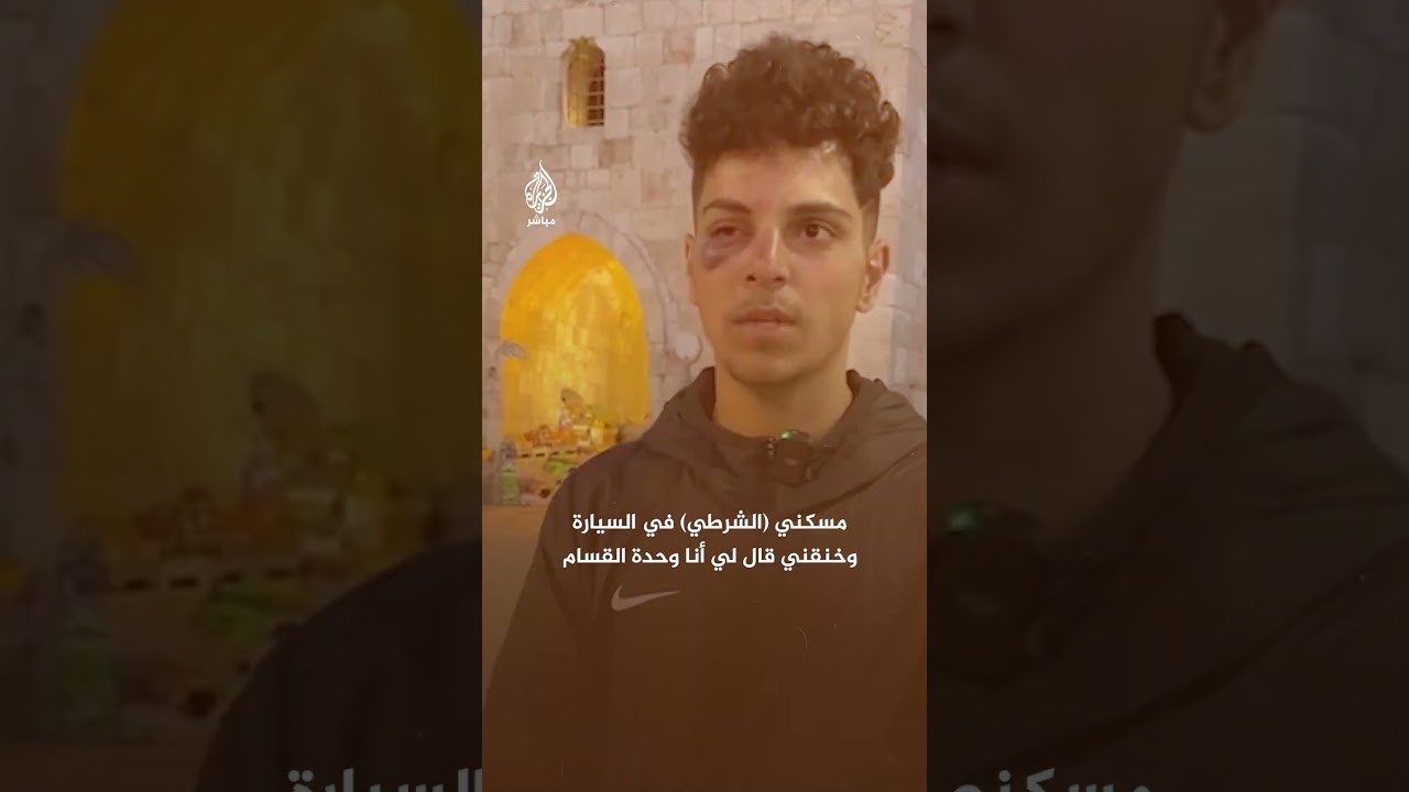 فتى مقدسي يروي تفاصيل مروعة لاعتداء قوات الاحتلال الإسرائيلي عليه