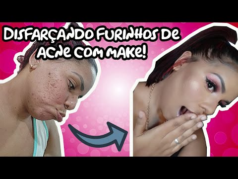 Vídeo: Maneiras fáceis de cobrir cicatrizes de acne com maquiagem (com fotos)