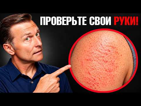 Rough Skin on Your Arms: What Those Bumps Mean and How Vitamin A Is Involved