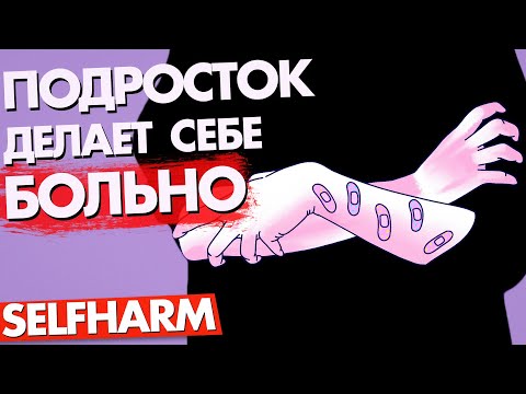 Видео: ПОЧЕМУ ПОДРОСТОК  СЕБЯ РЕЖЕТ, ЦАРАПАЕТ, ПРИЖИГАЕТ, КУСАЕТ