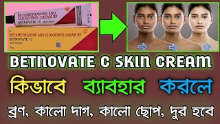 BETNOVATE C Cream এর ব্যাবহারের সঠিক নিয়ম || বেটনোভেট ক্রিমের কাজ ||  ত্বক ফর্সা করে BETNOVATE C screenshot 5