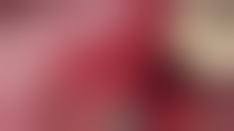 Dr. R. Crespi - Split crest technique with Magnetic Mallet