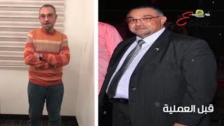 محمد وزنه كان 140كيلو قبل عملية تكميم المعدة. توقع كم الآن ؟