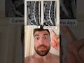 MRI Normal But Still Have Back Pain? Here's Why!