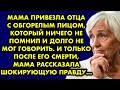 Мама привезла отца с обгорелым лицом, который ничего не помнил и долго не мог говорить. И только…