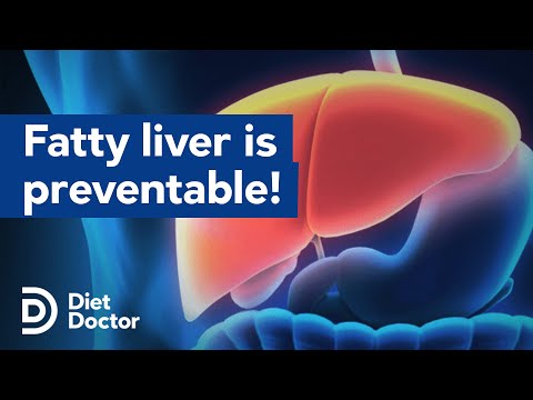 Videó: A zsírmáj megöl?