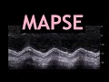 How to measure mapse echocardiography