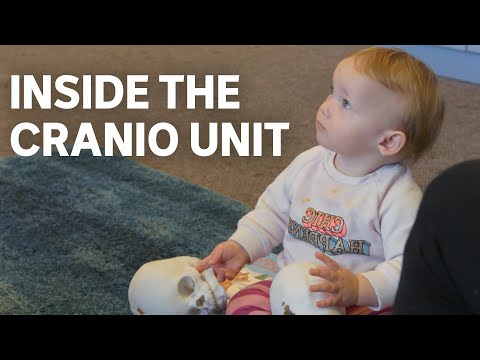 “Is my baby's head a normal shape?” | Craniosynostosis