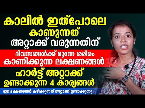 This Is The First Sign Of An Attack On Your Feet 