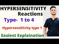 Hypersensitivity reactions  hypersensitivity type 1 hypersensitivity reactions type 1234