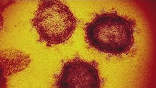 COVID-19 pandemic no longer qualifies as global health emergency, WHO says