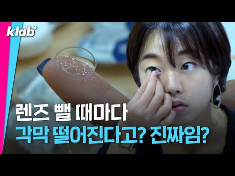 🚨렌즈 착용러 주목🚨 콘택트렌즈 뺄 때 각막 떨어진다는 말, 사실일까? 렌즈 빼는 법｜크랩