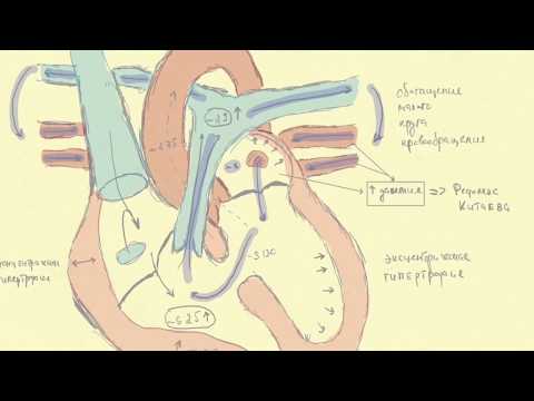 Видео: Врожденные пороки сердца: история меда