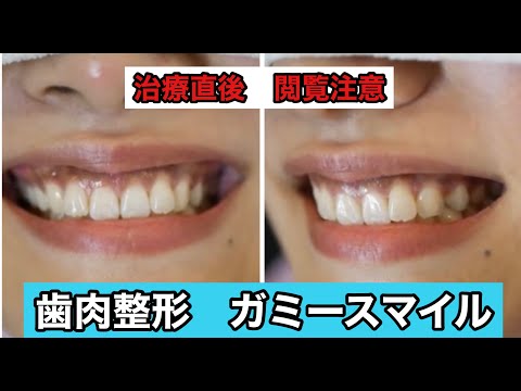 ガミースマイルのお悩み | 金融関連職 29歳 女性