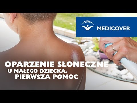 Wideo: Oparzenie Słoneczne U Dziecka: Co Zrobić, Jeśli Dziecko Się Poparzy