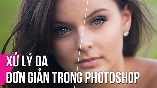 Xử Lý Da Đơn Giản Trong Photoshop | Thùy Uyên